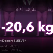 Weight Doctors® 3D-Bodyscan vorher und nachher: minus 20,6 kg mit Weight Doctors® SLEEVE, Körperfett minus 21,9 kg